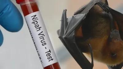 Cegah Virus Nipah: Cara Lindungi Diri dari Infeksi Maut