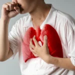 Data 18.846 Kasus TBC Bandung dan Target Penurunan